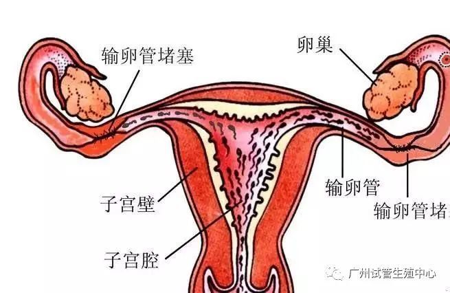 通草的功效与作用能通输卵管堵塞,可靠解答解释定义_入门版38.513